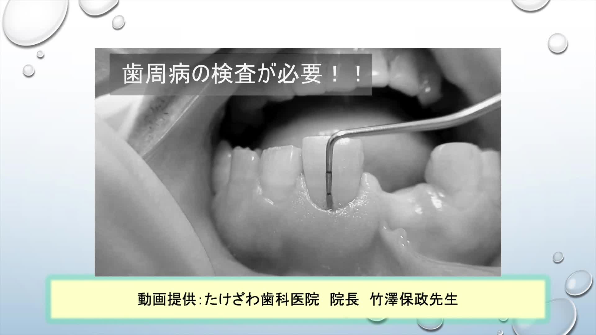 【2021年度版】見えない歯周病の落とし穴（歯周病サポート）
